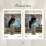 미금역 필라테스|거북목, 골반틀어짐 체형교정 회원들의 Before&After