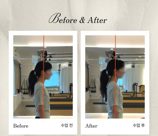 미금역 필라테스|거북목, 골반틀어짐 체형교정 회원들의 Before&After